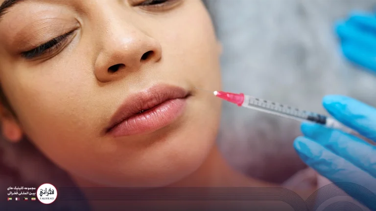 بوسیدن بعد از تزریق ژل لب