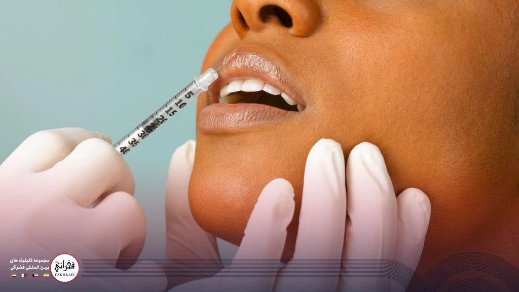 درمان تبخال بعد از ژل لب-تزریق ژل به لب های خانمی
