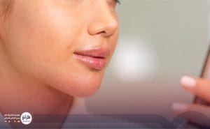 تزریق ژل لب عروسکی