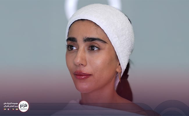 با تزریق ژل لب مدل صدفی از زیبایی خیره‌کننده خود لذت ببرید.