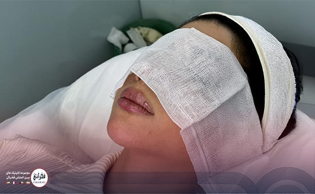 همه چیز در مورد تزریق ژل لب مدل چاک دار و مراقبت های لازم آن