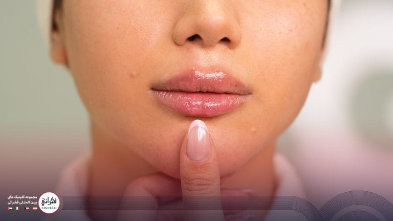 تزریق ژل لب مدل قلوه‌ای؛ روشی محبوب برای ایجاد جلوه‌ای خاص