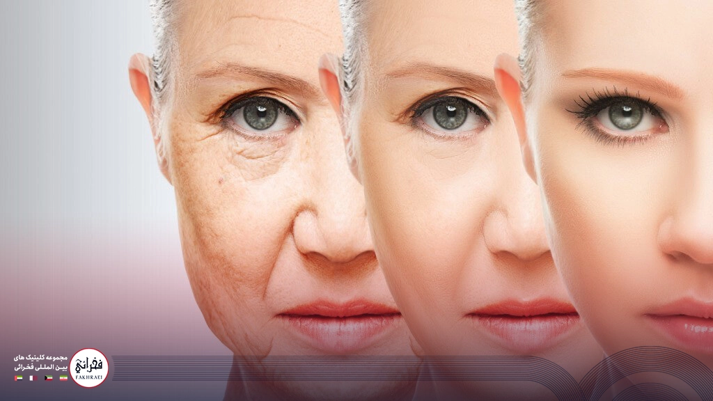 جوانسازی دور چشم-سه مرحله صورت خانومی بعد از درمان چروک صورت