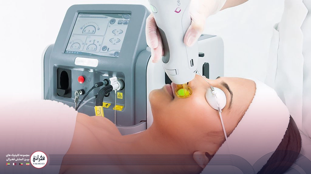 لیزر کندلا چیست؟