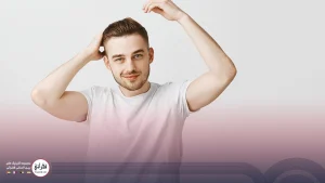 کاشت مو به روش تکثیر