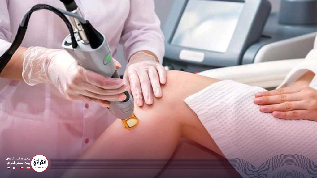 لیزر کندلا بهتره یا نابلکس؟-در حال انجام لیزر کندلا روی پای خانمی