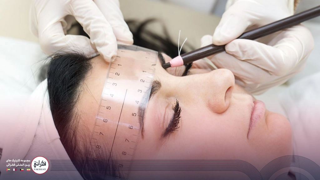 کاشت ابرو به روش FIT-در حال کاشت ابرو خانمی