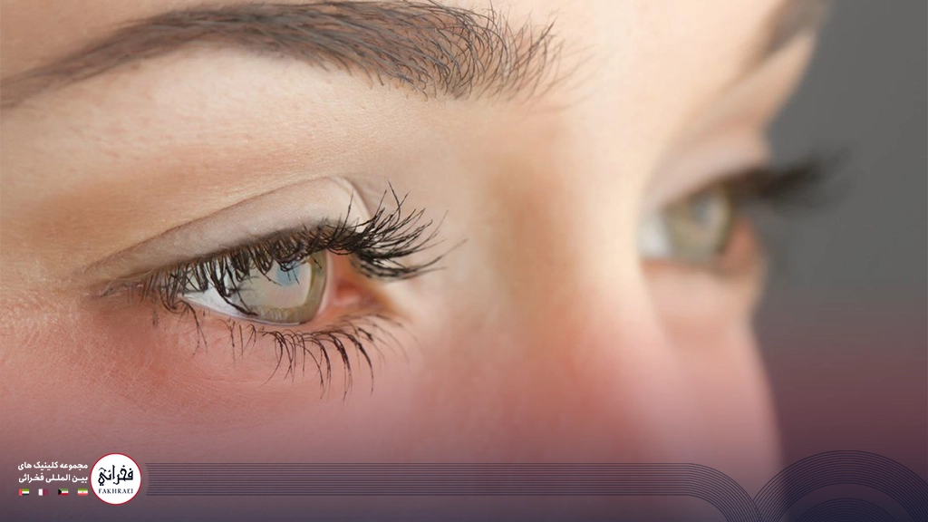 کاشت ابرو به روش FIT -خانمی با ابروی زیبا