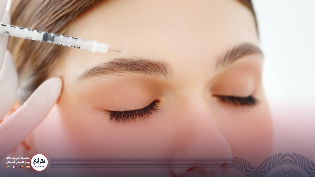 تزریق بوتاکس بالای ابرو