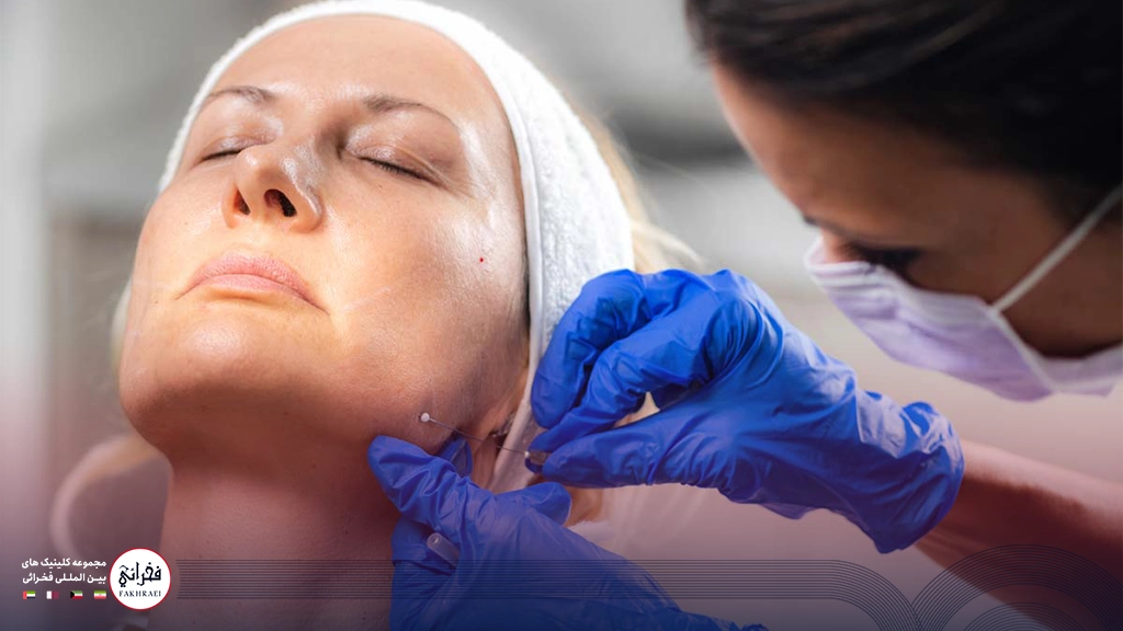 لیفت گونه با نخ چیست؟