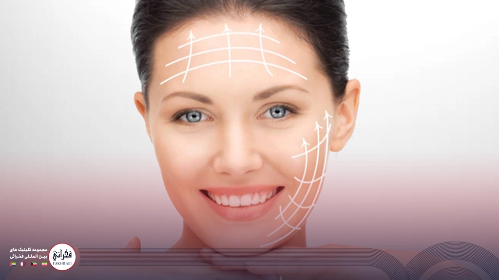 مراقبت‌های بعد از لیفت گونه با نخ