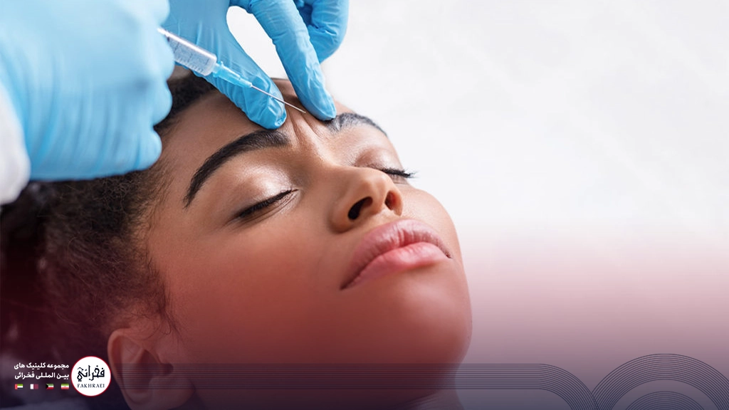 بوتاکس دور چشم-تزریق بوتاکس دور چشم