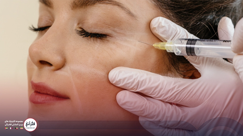 بوتاکس دور چشم-در حال تزریق بوتاکس دور چشم