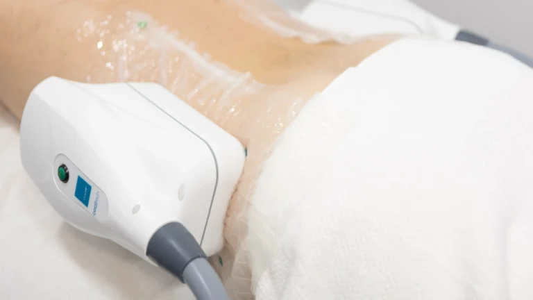 دستگاه کول تک چیست؟ + مزایای لاغری با استفاده از این دستگاه