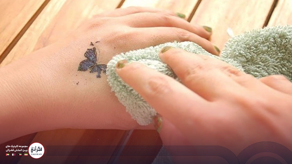 در حال پاک کردن تاتو 