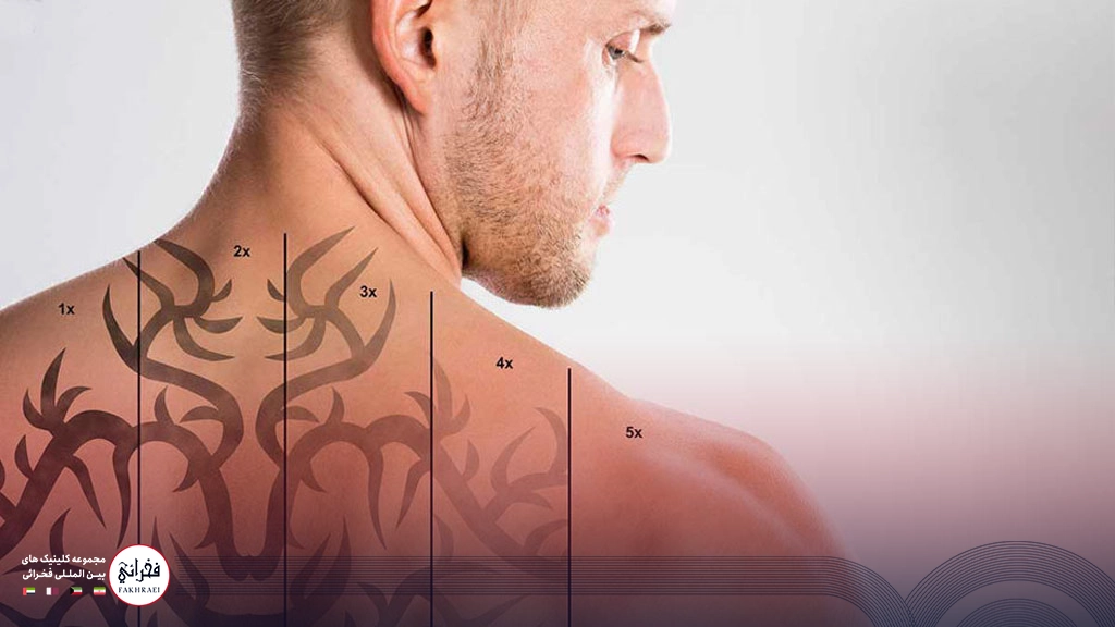 تاتو پشت کمر 