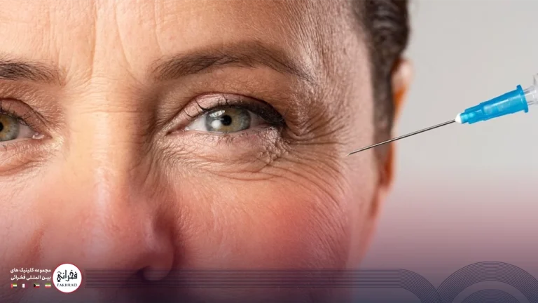 عوارض فیلر زیر چشم