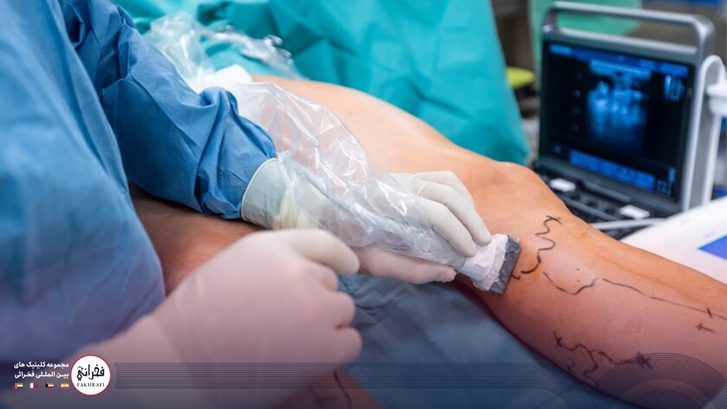 درمان واریس پا با لیزر