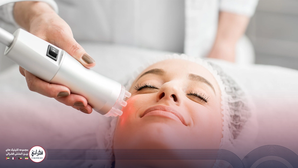 لیزر فوتونا برای درمان لک صورت