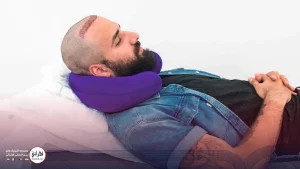 نحوه خواب بعد از کاشت مو