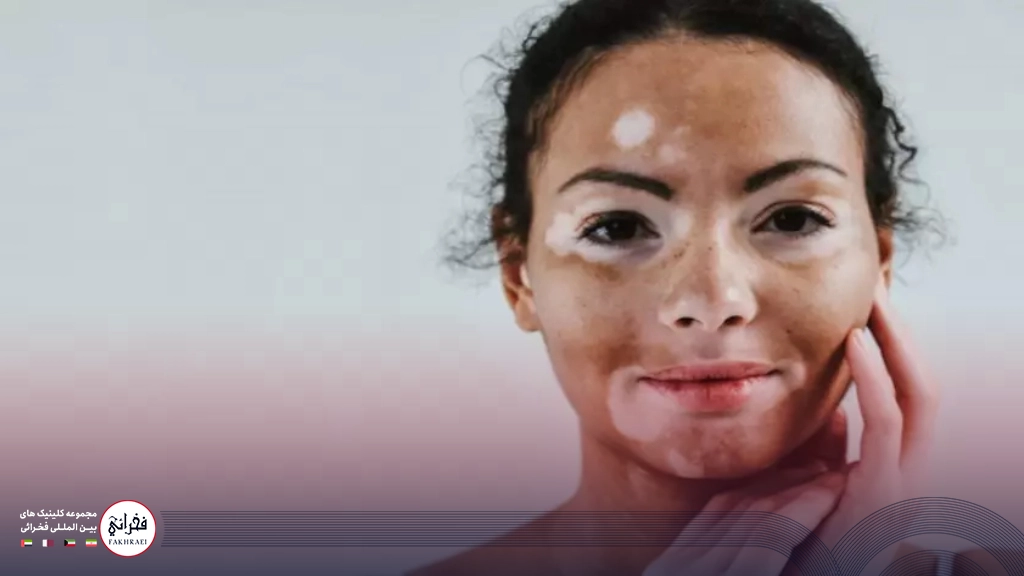 پیسی روی صورت خانمی