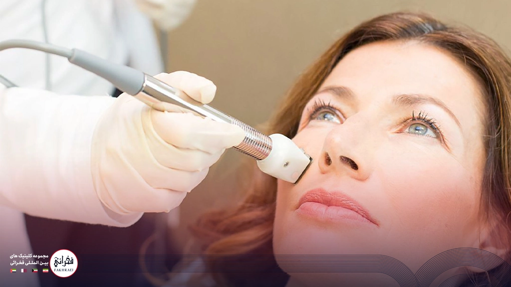 آر اف فرکشنال 