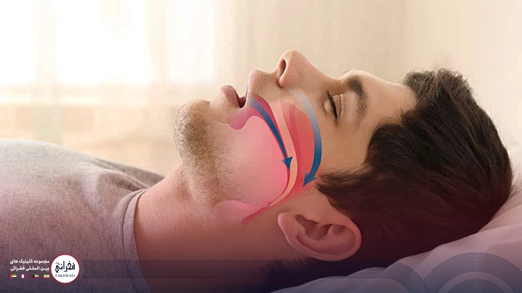 تصویر مردی که هنگام خواب خروپف میکند