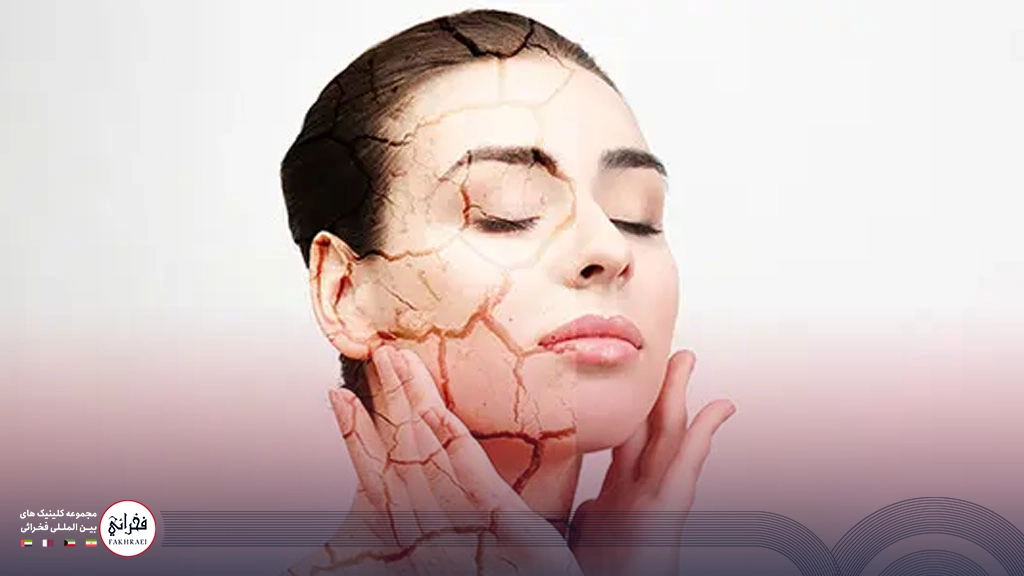 پوست خانمی با ترک و خشکی پوست