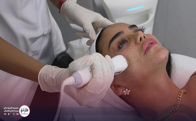 آر اف فرکشنال