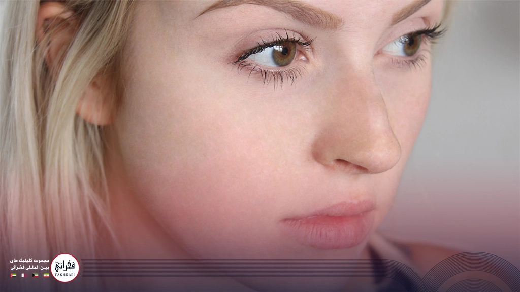 درمان جوشهای زیر پوستی صورت و داشتن صورتی صاف