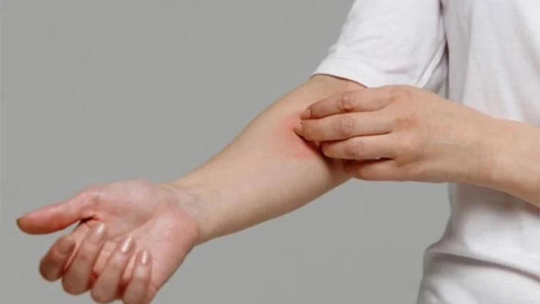 درمان اگزمای پوستی در کلینیک پوست و موی فخرائی