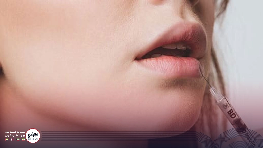 تزریق آنزیم برای تخلیه ژل