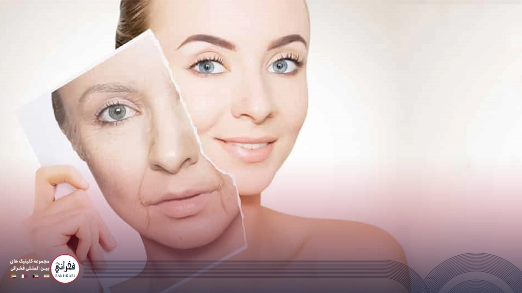 قبل و بعد از تزریق مزوژل