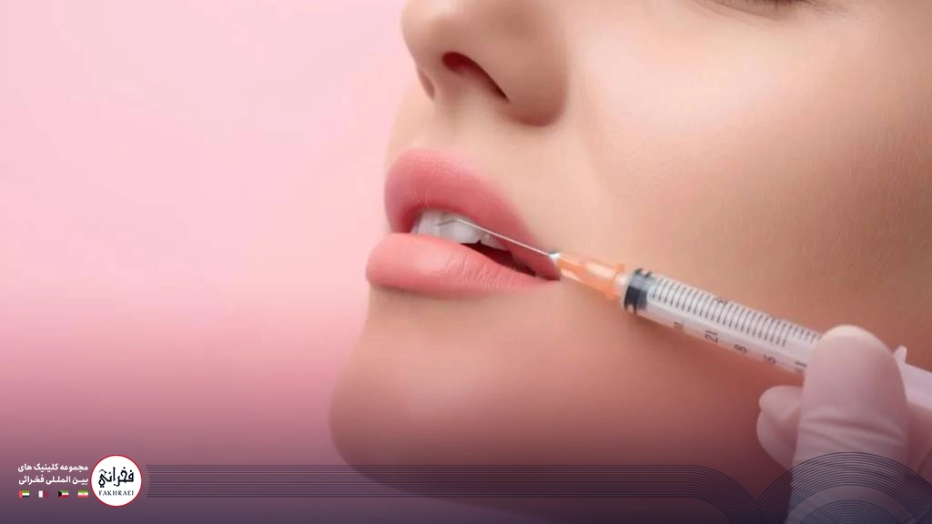 تزریق ژل به لب بالایی