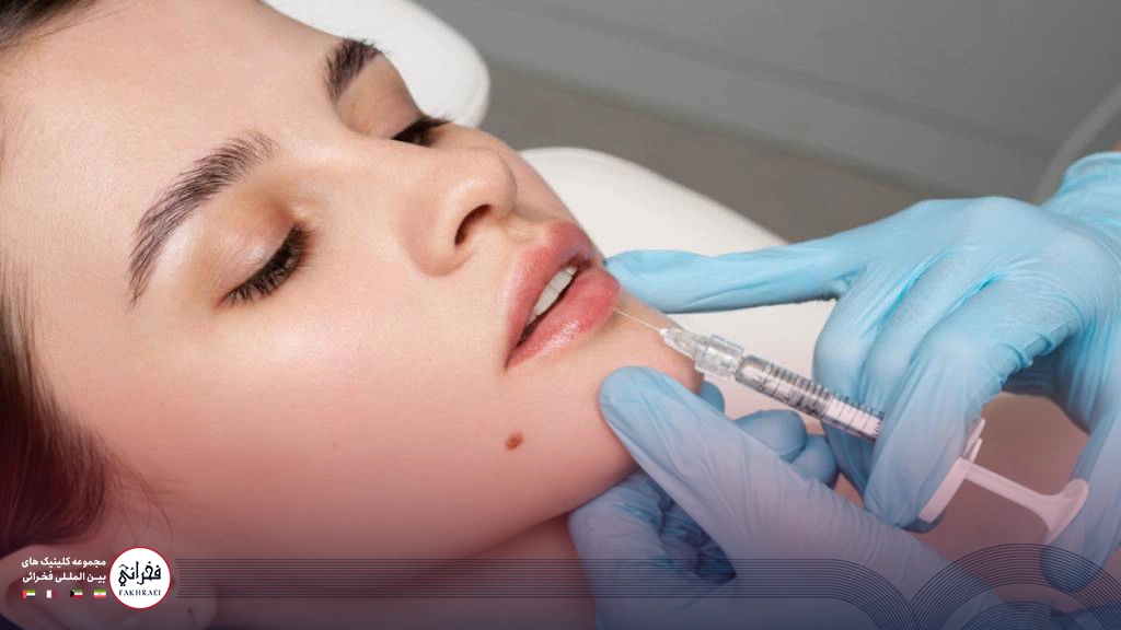 تزریق ژل به لب پایین