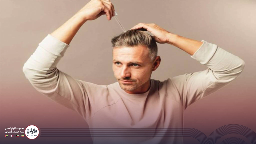 مراحل استفاده ماینوکسیدیل بعد از کاشت مو