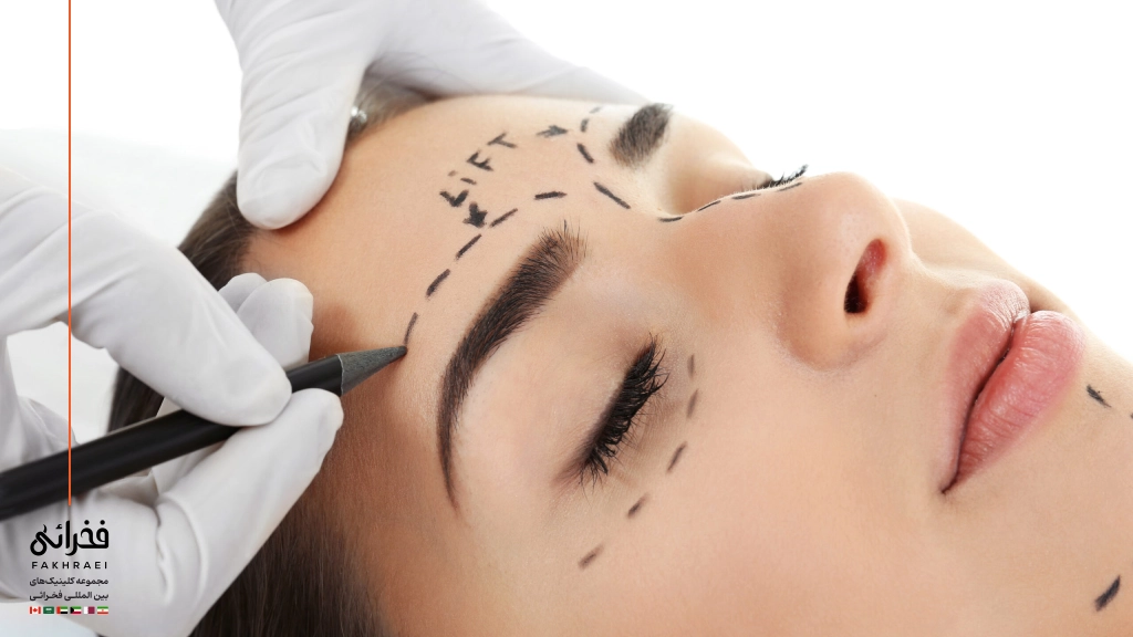 مراحل لیفت ابرو