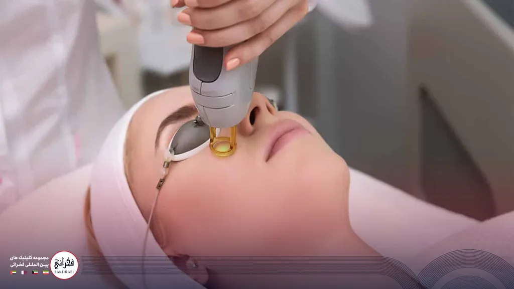 درمان جای جوش با لیزر co2