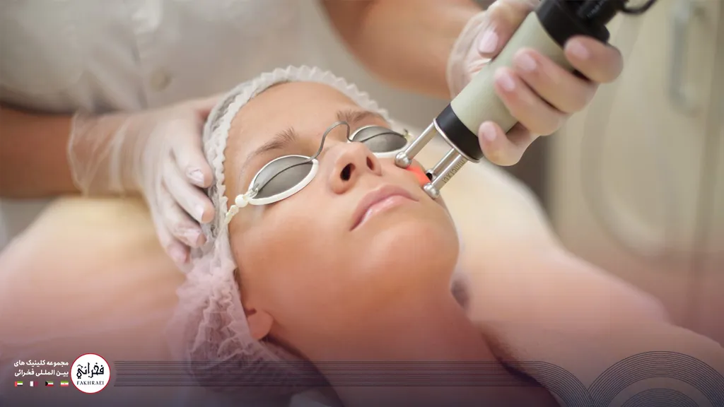 درمان جای جوش با لیزر فوتونا