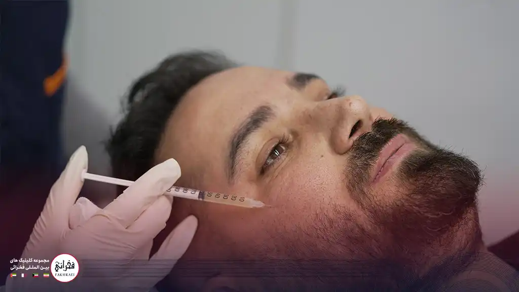 فرایند تزریق پی آر پی صورت برای یک مرد