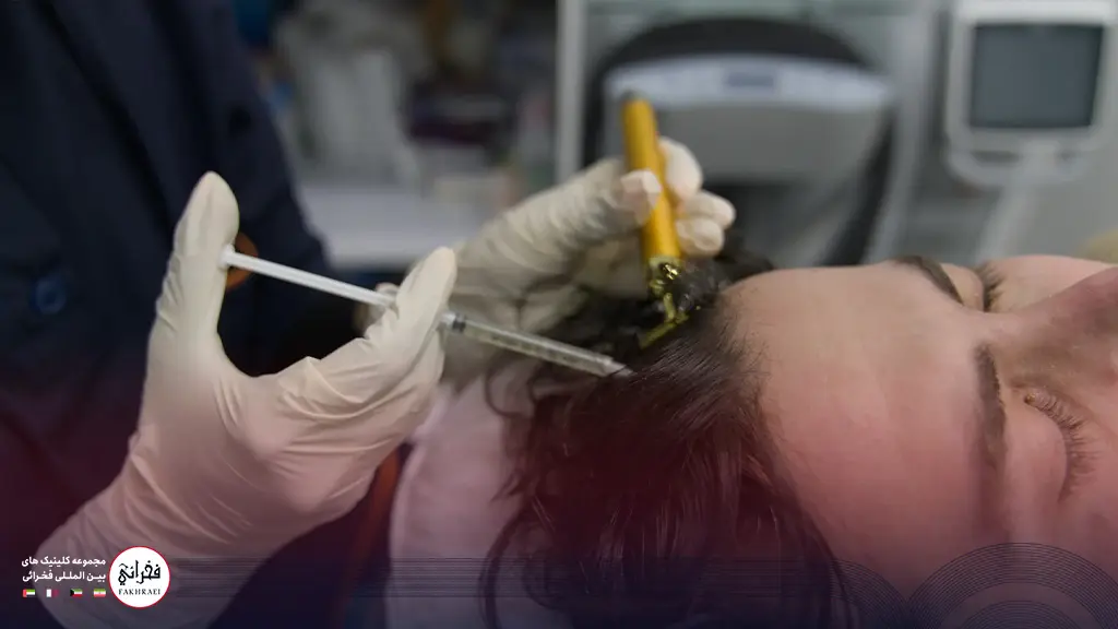 تزریق پی آر پی مو به سر یک مرد