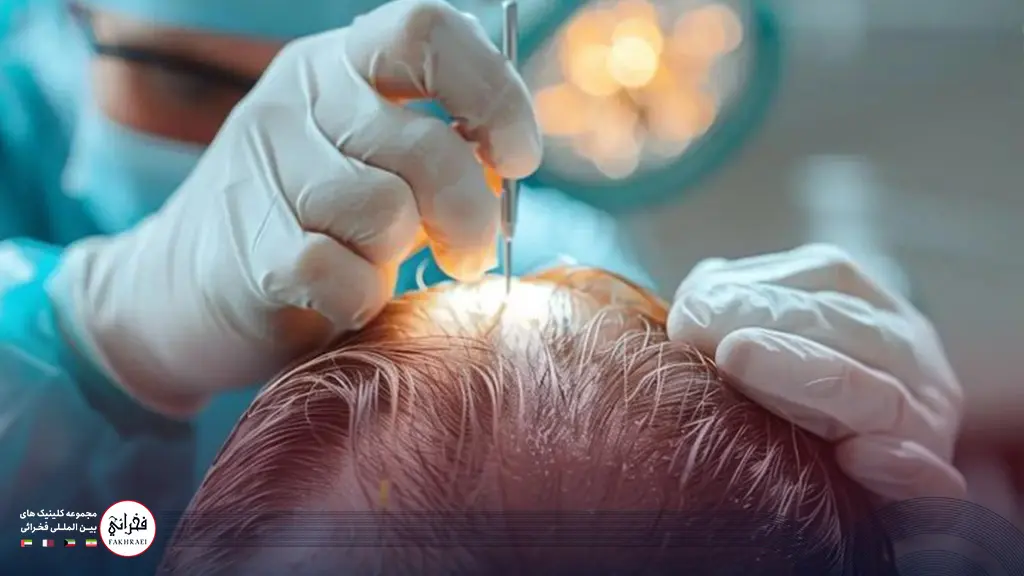 عوامل موثر بر شدت زخمهای کاشت مو