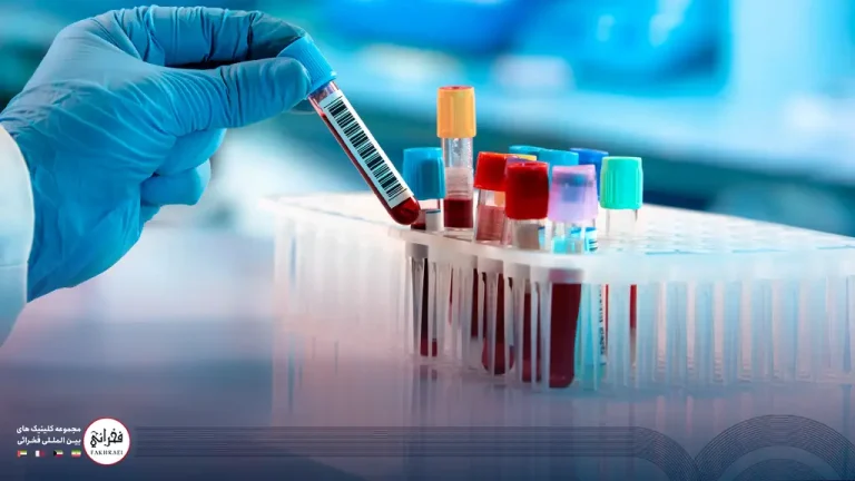 آزمایش های قبل از کاشت مو