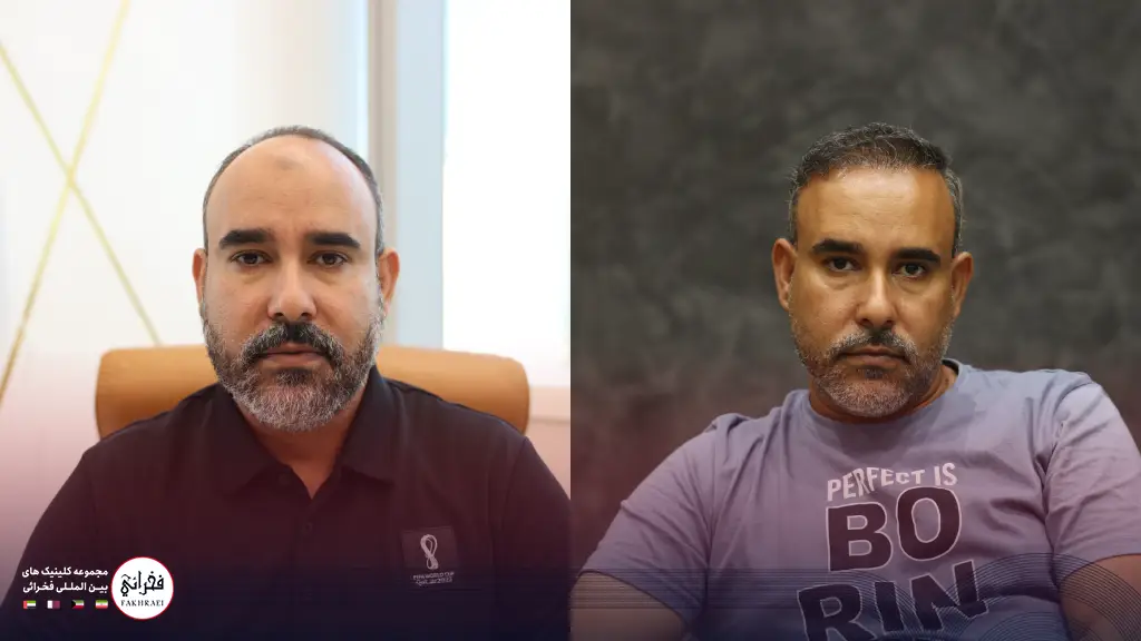 کاشت مو در کلینیک زیبایی فخرایی