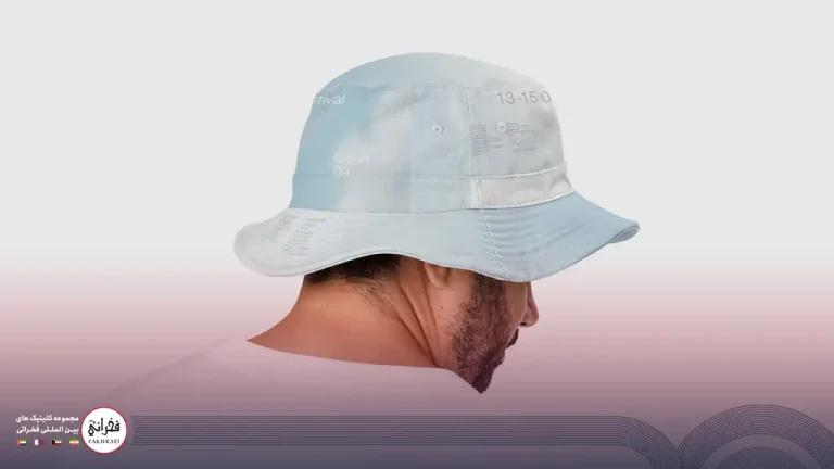 استفاده از کلاه بعد از کاشت مو