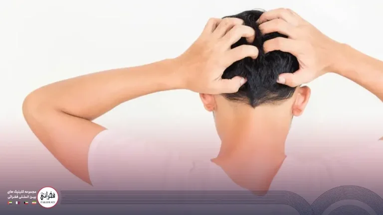 خارش سر بعد از کاشت مو