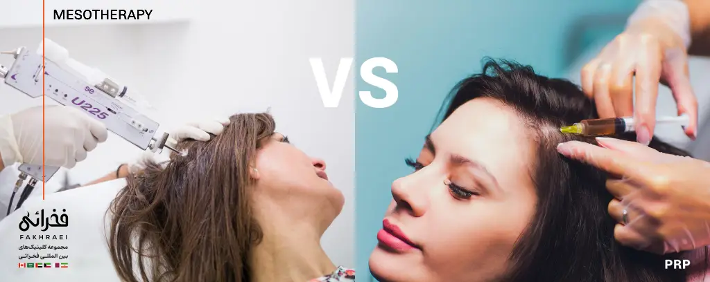 بعد از کاشت مو پی آر پی بهتر است یا مزوتراپی؟