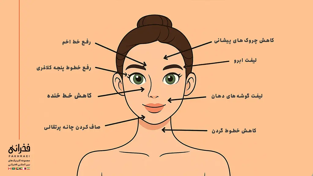 کاربردهای بوتاکس صورت