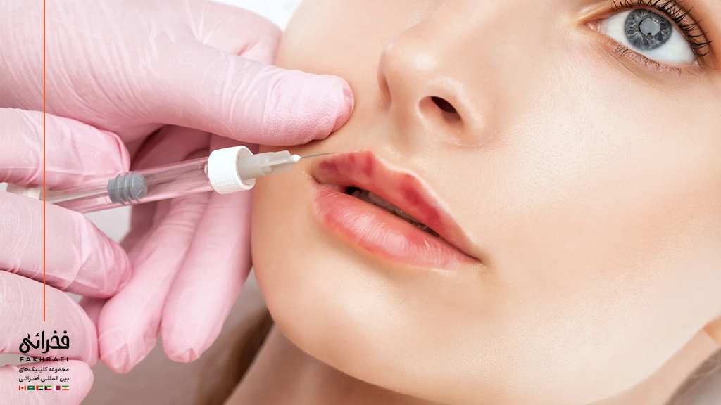فیلر بهتر است یا بوتاکس-تزریق فیلر لب