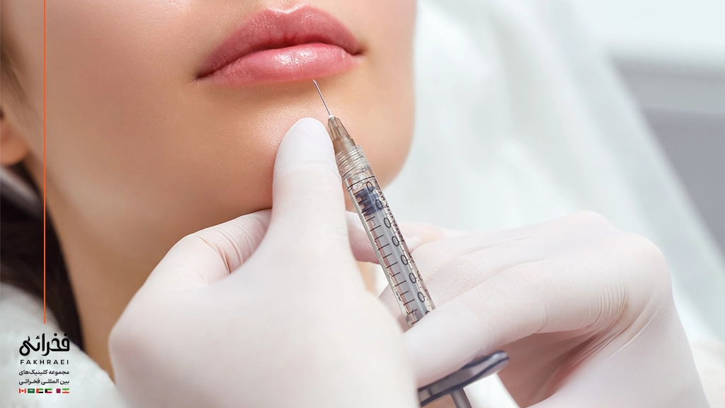 فیلر بهتر است یا بوتاکس-تزریق فیلر لب